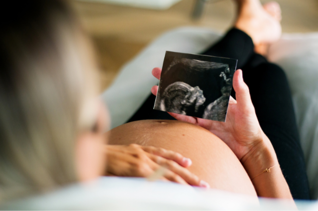 Mulher grávida segurando foto da ultrassom do seu bebê